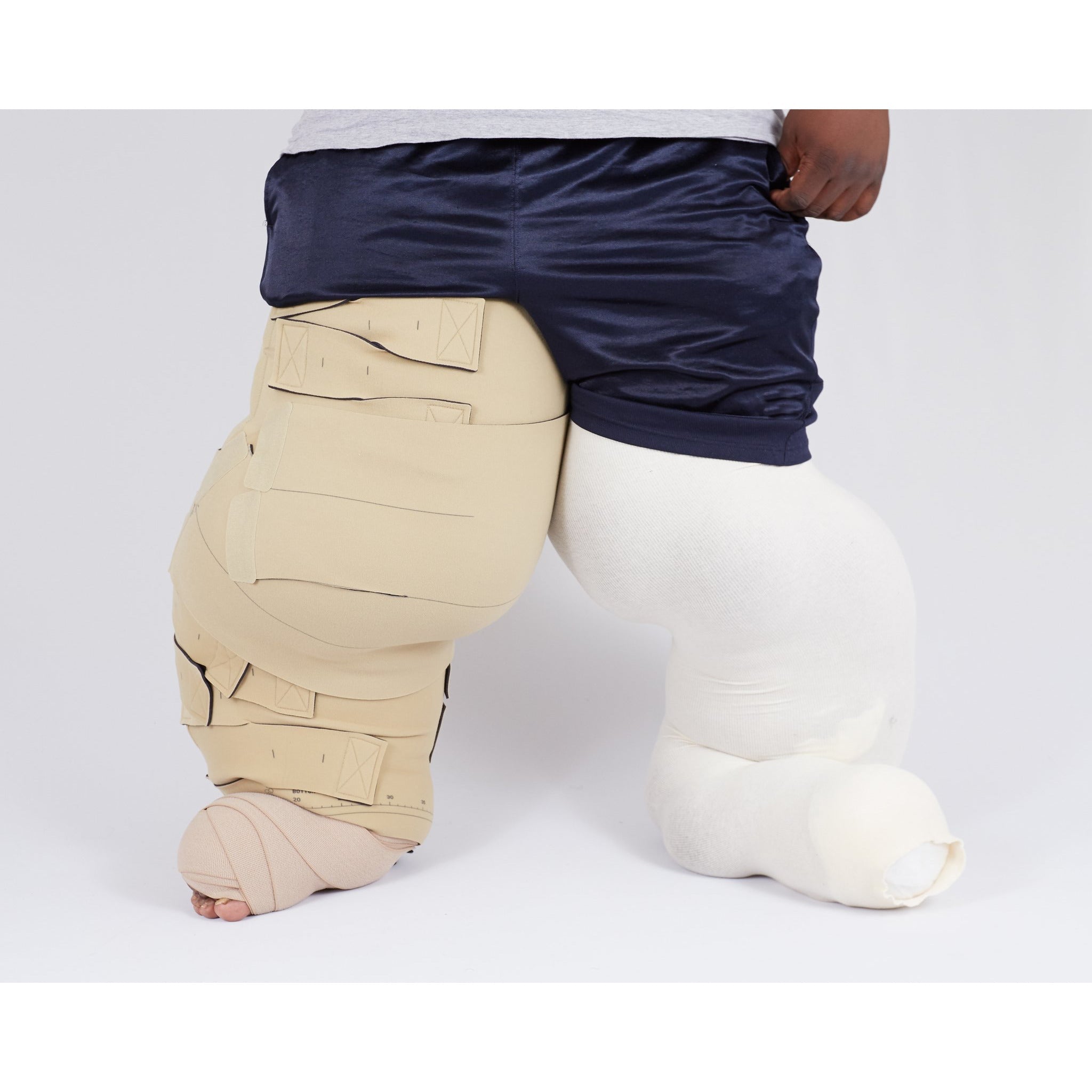 Circaid Lobe Reduction Kit for Lymphedema – Compression Stockings